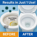 GermMukt™ All in 1 Toilet Cleaning Spray | Buy 1 Get 2 Free
